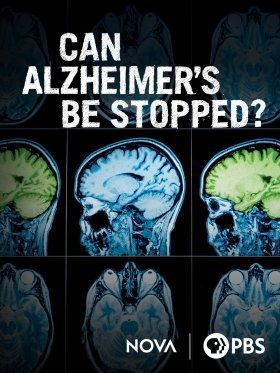 Can Alzheimers be Stopped; / Αλτσχάιμερ: Υπάρχει Ελπίδα; (2001)