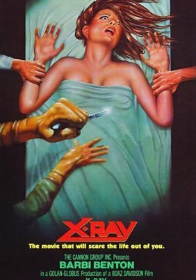Ακτίνα θανάτου / Hospital Massacre / X-Ray (1981)