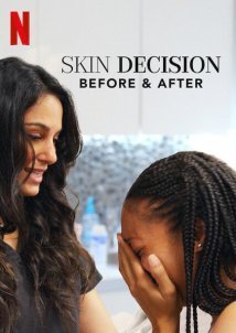 Skin Decision: Before and After (2020)